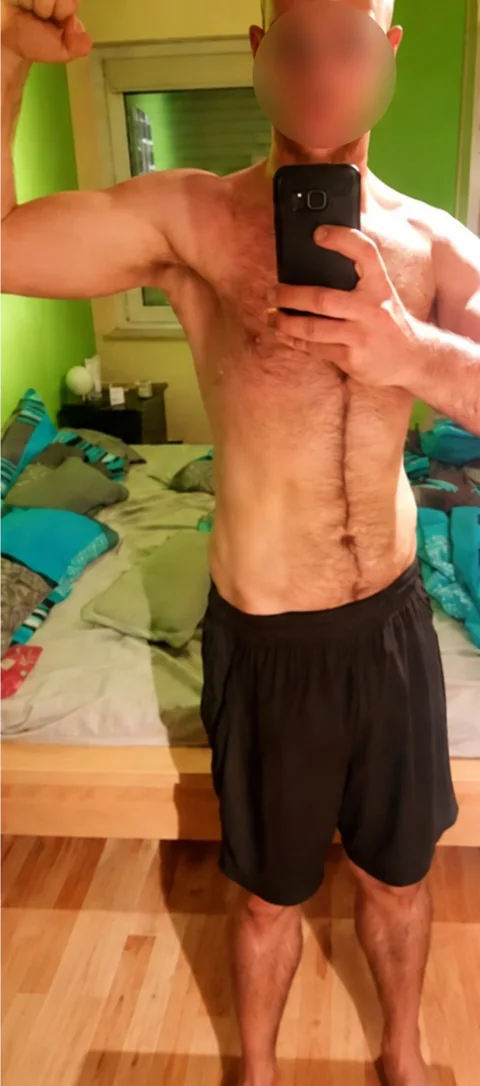 Germán después de aplicar el enfoque DN Feeding