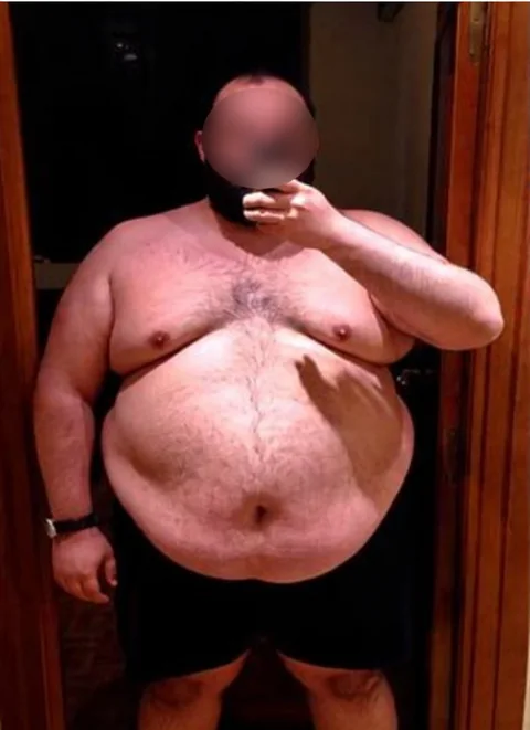 Maxi antes de aplicar el enfoque DN Feeding